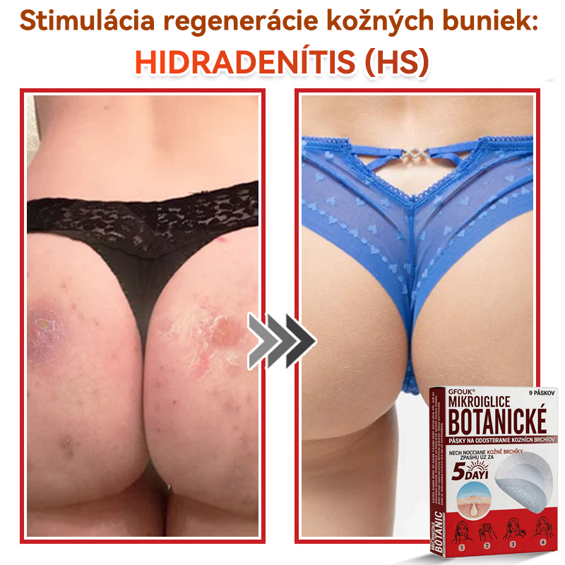 💕✅GFOUK® MicroNeedle botanic náplasť na odstránenie kožných výrastkov Vyrobené