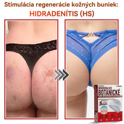 💕✅GFOUK® MicroNeedle botanic náplasť na odstránenie kožných výrastkov Vyrobené