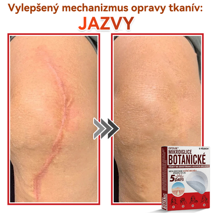 💕✅GFOUK® MicroNeedle botanic náplasť na odstránenie kožných výrastkov Vyrobené