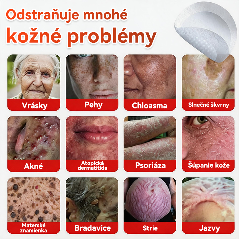 💕✅GFOUK® MicroNeedle botanic náplasť na odstránenie kožných výrastkov Vyrobené