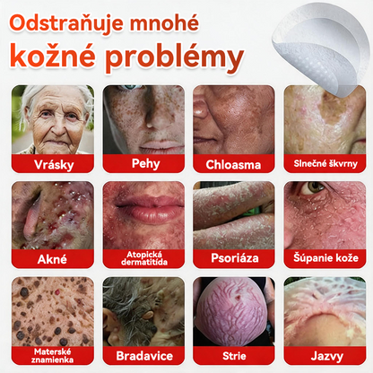 💕✅GFOUK® MicroNeedle botanic náplasť na odstránenie kožných výrastkov Vyrobené