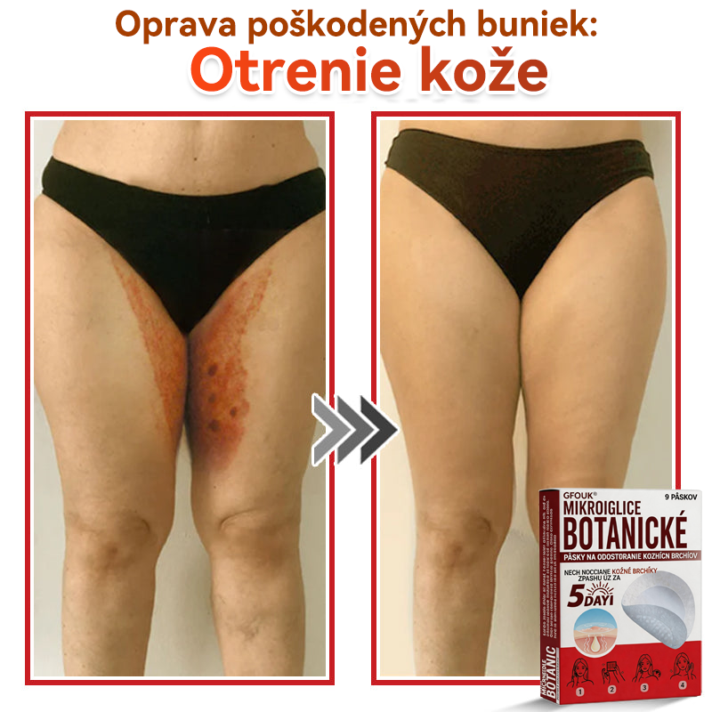 💕✅GFOUK® MicroNeedle botanic náplasť na odstránenie kožných výrastkov Vyrobené
