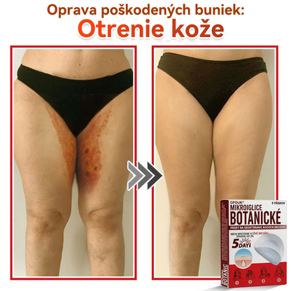 💕✅GFOUK® MicroNeedle botanic náplasť na odstránenie kožných výrastkov Vyrobené
