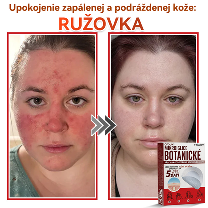 💕✅GFOUK® MicroNeedle botanic náplasť na odstránenie kožných výrastkov Vyrobené