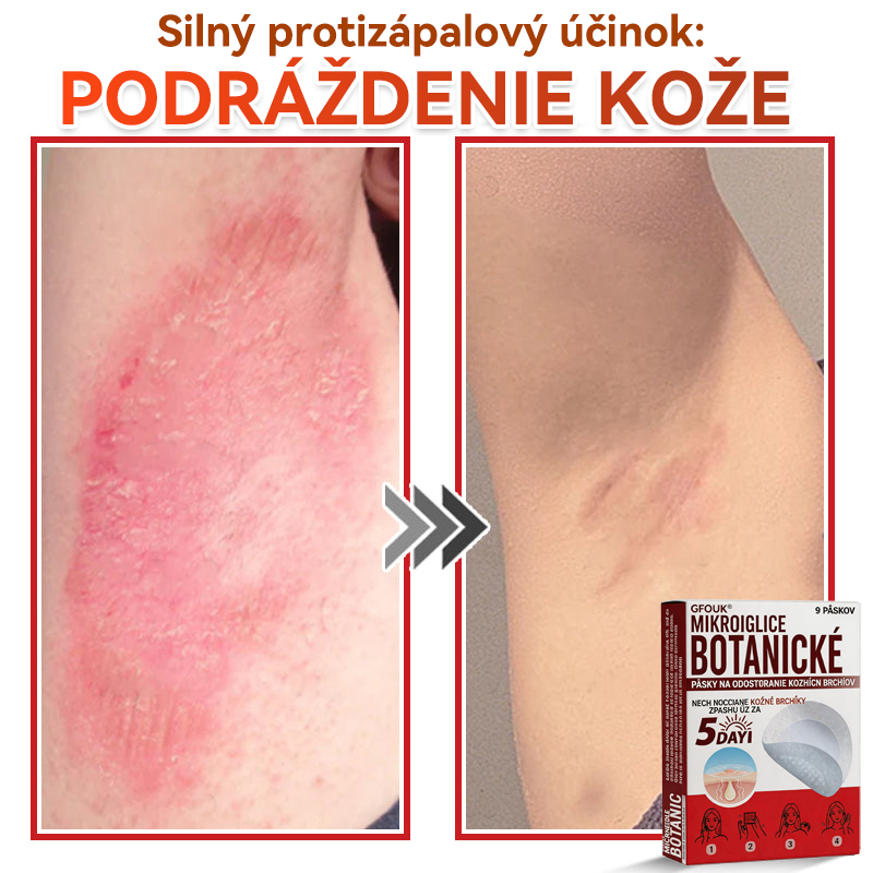 💕✅GFOUK® MicroNeedle botanic náplasť na odstránenie kožných výrastkov Vyrobené