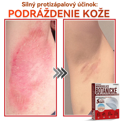💕✅GFOUK® MicroNeedle botanic náplasť na odstránenie kožných výrastkov Vyrobené